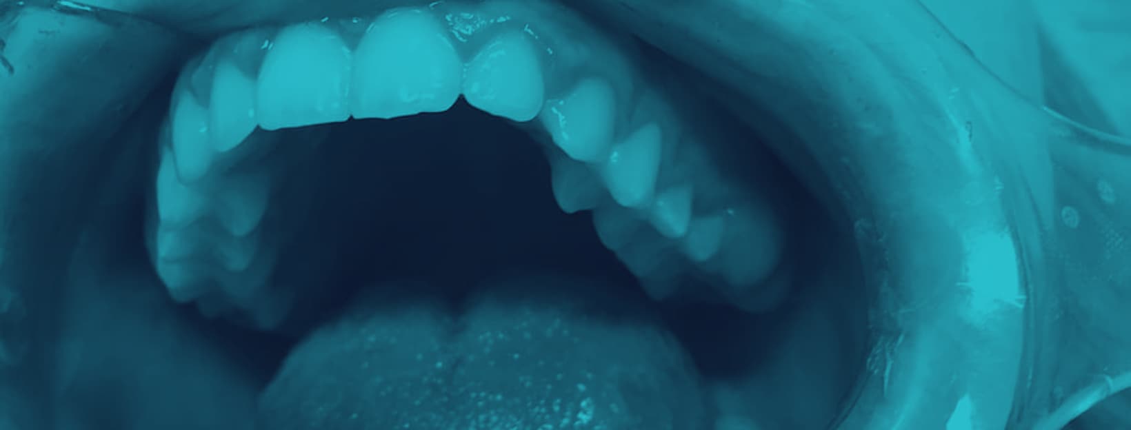 Aging Teeth and Radical Life Extension